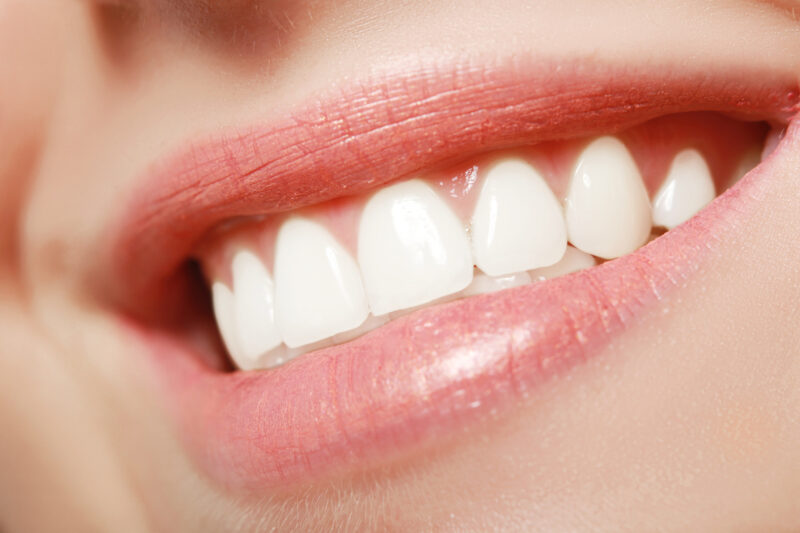 Smile