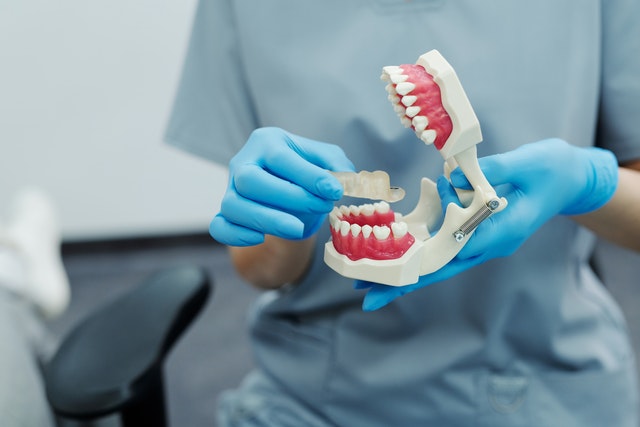 Photo by Cedric Fauntleroy: https://www.pexels.com/photo/a-person-holding-a-teeth-model-4269700/
